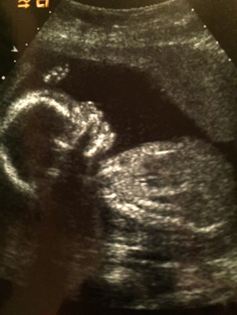 File Jan 11, 9 06 58 PM